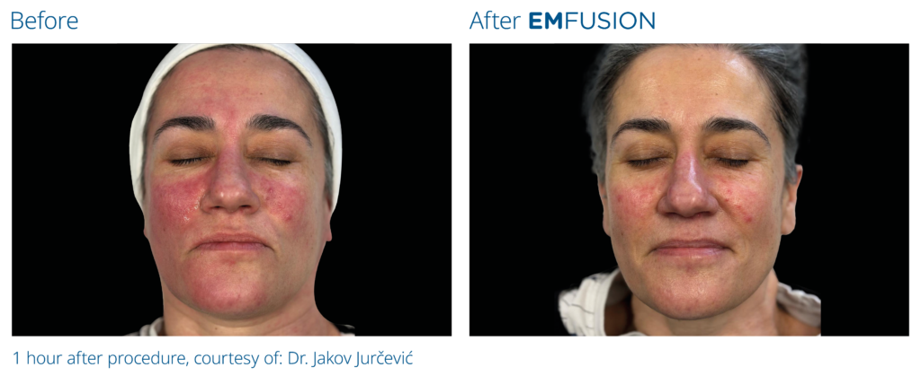 Emfusion_PIC_Ba-card-female-008_PL100