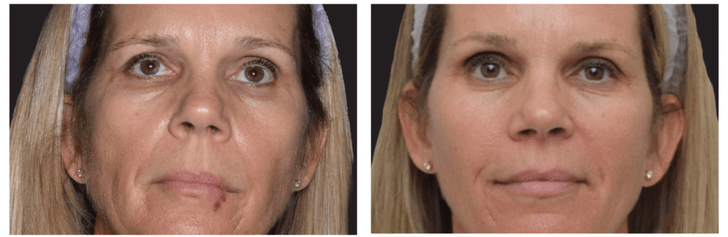 Exion_PIC_Ba-card-face-female-068_FRF_PL100